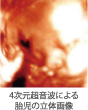 胎児の立体映像